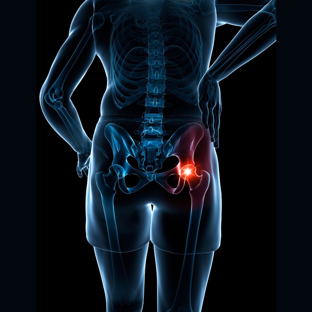 Replay Live: Hip Pain Solution Workshop