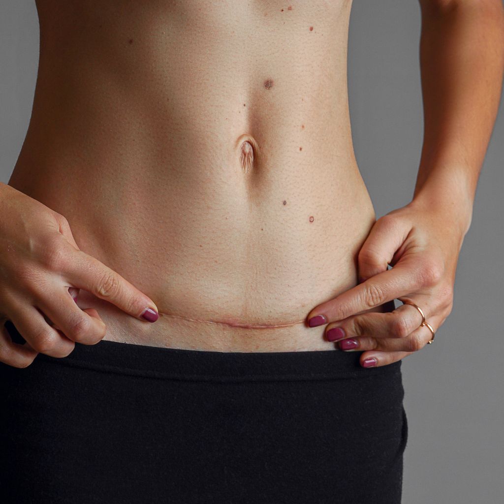 Replay of Live: B3 Scars Workshop: Understanding How Scars Disrupt Stability and Function