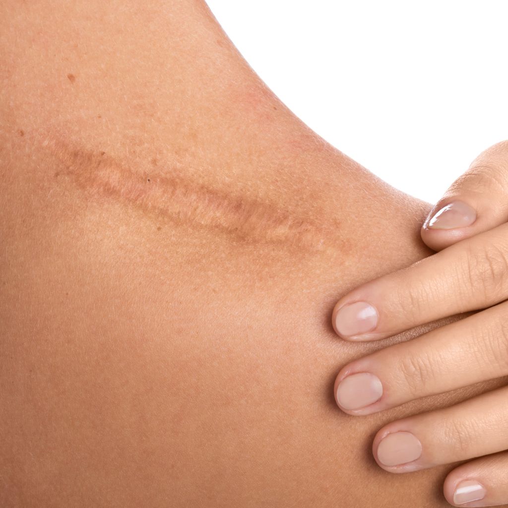 Replay of Live: B3 Scars Workshop: Understanding How Scars Disrupt Stability and Function