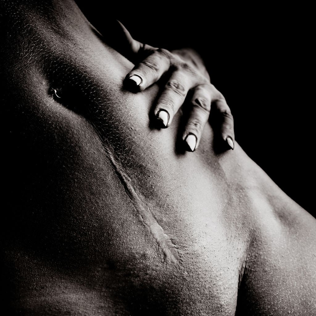Replay of Live: B3 Scars Workshop: Understanding How Scars Disrupt Stability and Function