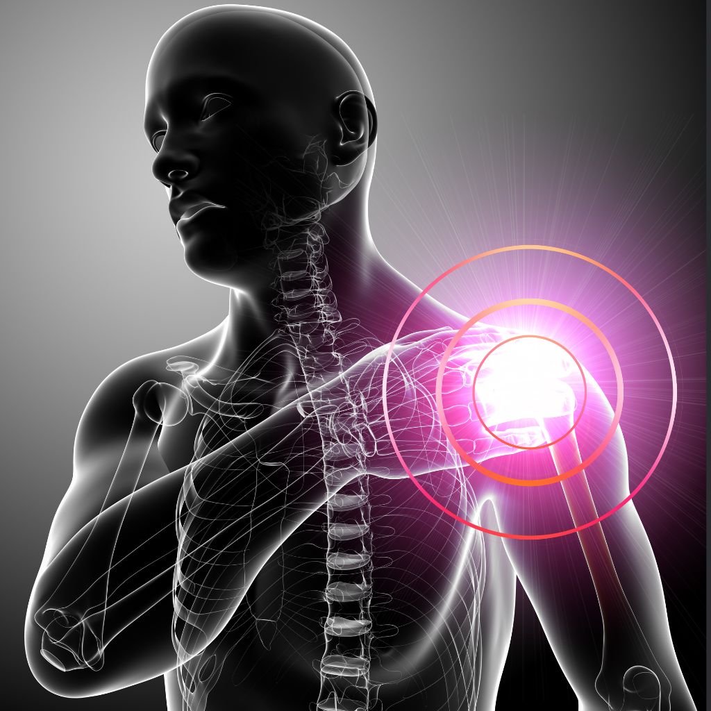 Replay of Live: Shoulder Pain Introductory Solution Workshop