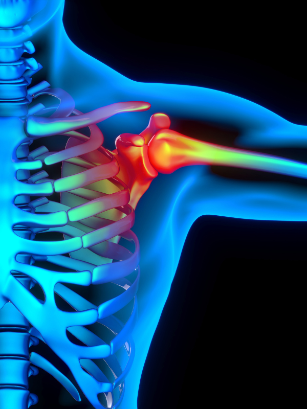 Replay of Live: Shoulder Pain Introductory Solution Workshop