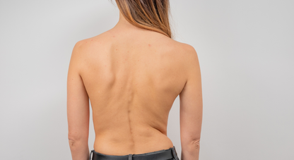 Live: Scoliosis Workshop