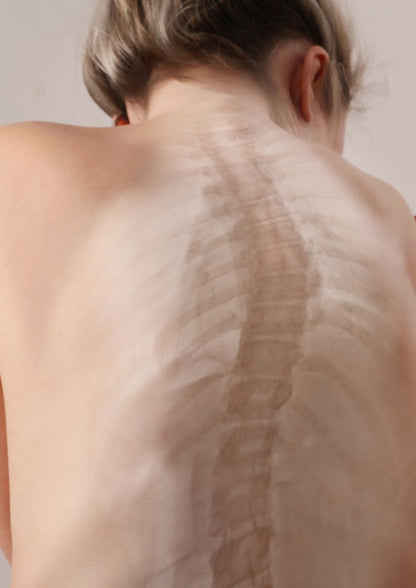 Replay of Live: Scoliosis Solution Workshop